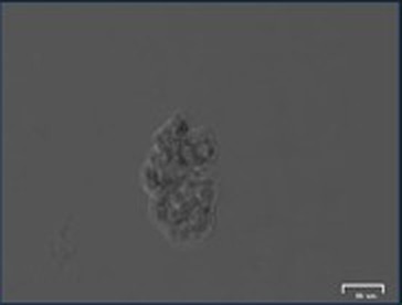 Brightfield microscopy of the recovered biopsy piece